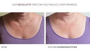 SilcSkin before and after decollette pad