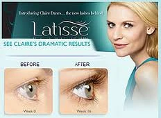 Latisse before and after
